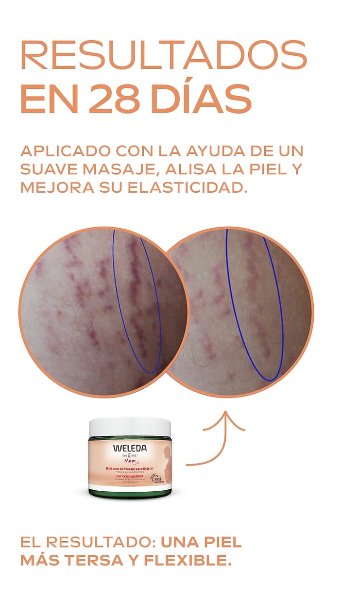 Dúo Rutina de Masaje para Estrías